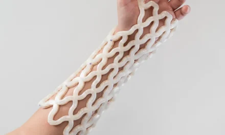 This 3D-printed cast shapes to your arm—and makes healing a broken bone more comfortable