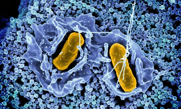 Why are there so many Salmonella outbreaks? 4 reasons for the nonstop food recalls, sicknesses, and safety warnings this year